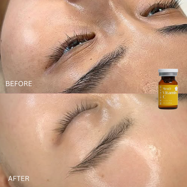 Medisco Meso Vitamin C 4ml (Individual)