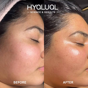 Hyalual Glow Enhancing Peel (50ml)