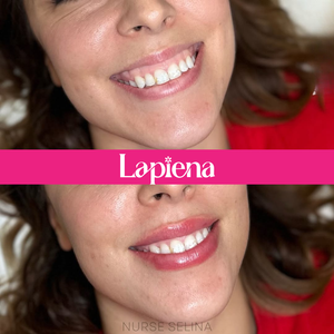 Lapiena Deep (with Lidocane)